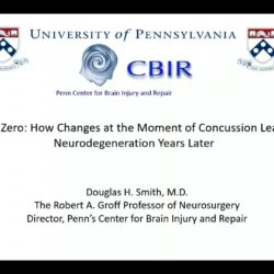 Join our guest Dr. Doug Smith as he gives a seminar about the effect of Concussion on Neurodegeneration
